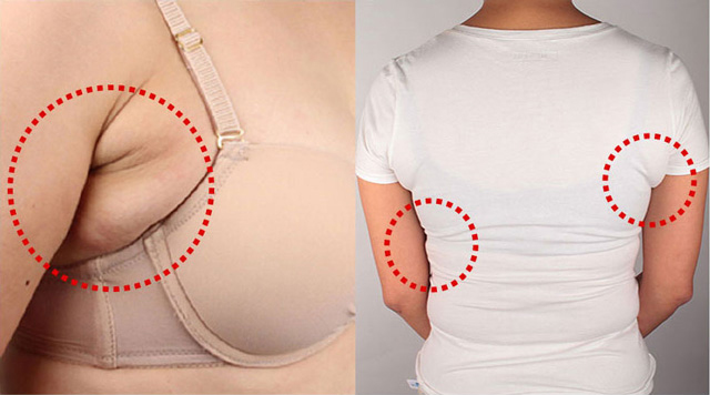 �e�����͂ݏo��I�u���W���[����͂ݏo�Ă��܂������̌����Ɖ������@�Ƃ́H