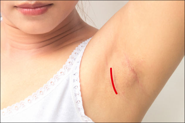 ���̋����̃I�b�p�C�͖{���E�U���H�L����p�̋U��������������@�I